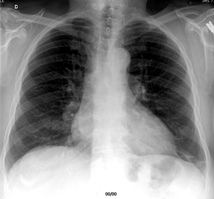Radiographie numérisée - imagerie médicale - Centre de radiologie de Poissy